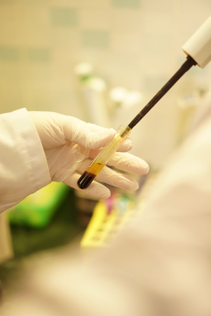 services-img Close-up of a scientist's gloved hand holding a test tube with blood sample in lab setting.