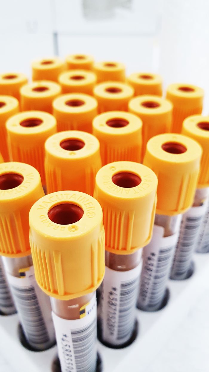 services-04 Detailed close-up of several test tubes with yellow caps used in medical testing in a laboratory.