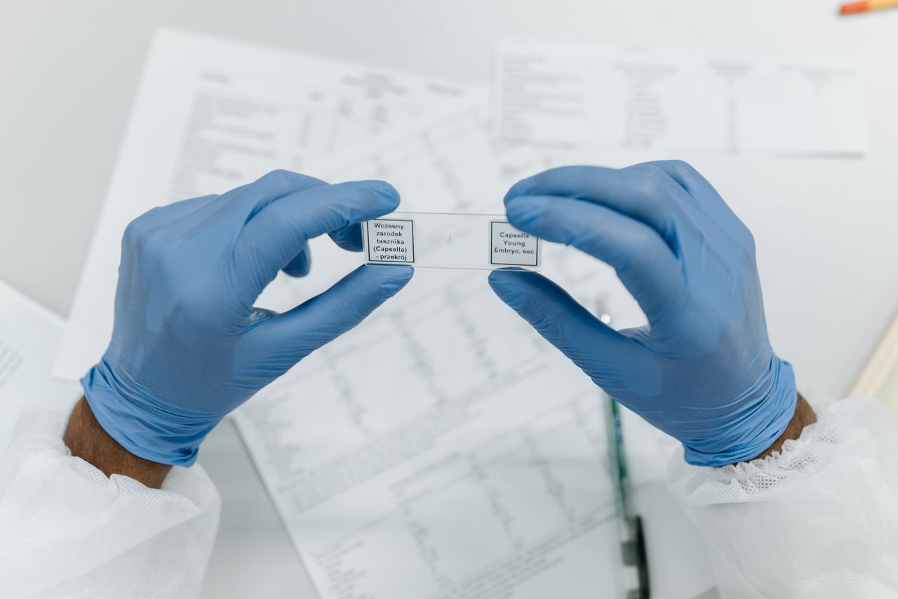 Researcher holds labeled microscope slides wearing blue gloves, in a laboratory setting.